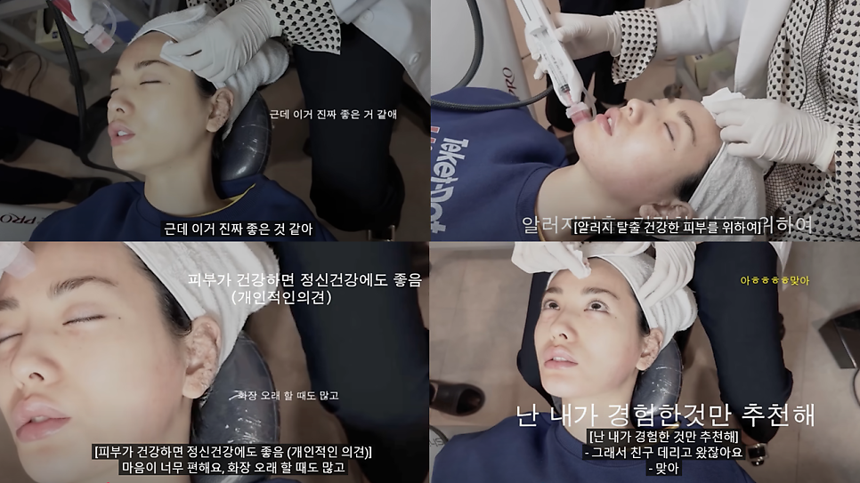 PRP Fat Grafting to Correct a Peanut-Shaped Face image 7