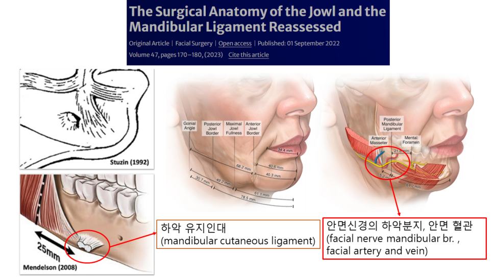 입가 주름 리프팅, 마리오네트 라인 개선하는 방법 관련 이미지 3