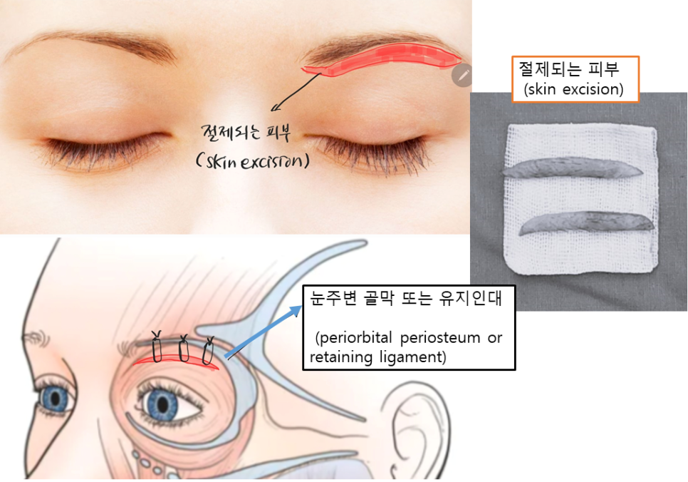 5월, 아버지께 드린 작은 변화 &ndash; 남자 눈썹하거상 관련 이미지 1