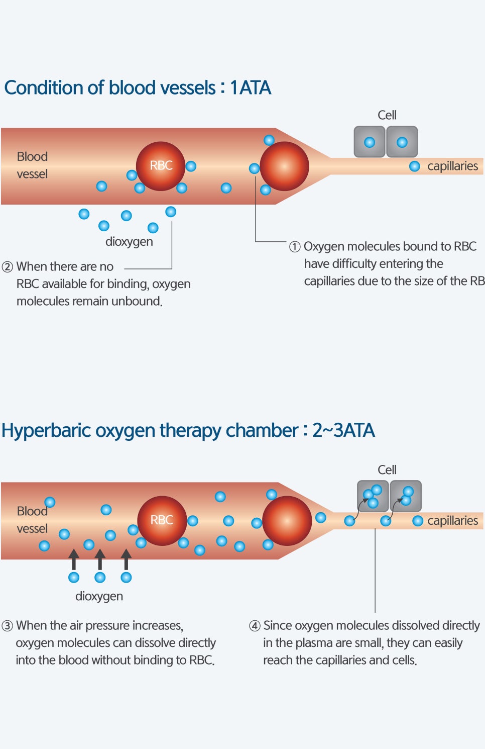Hyperbaric Oxygen Therapy for Faster Recovery After Plastic Surgery image 1