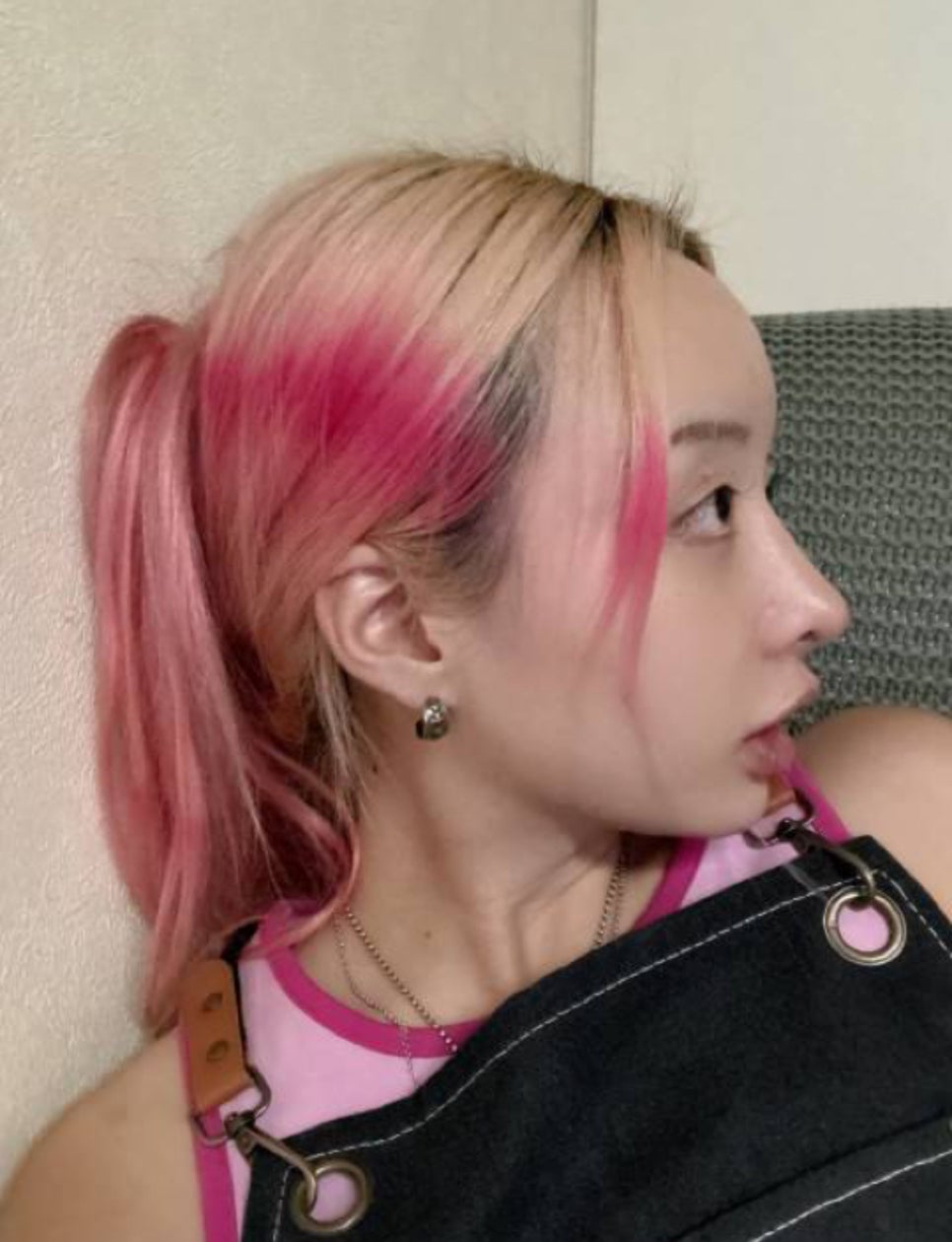 코성형후에 코가 휘었을때의 재수술 관련 이미지 16
