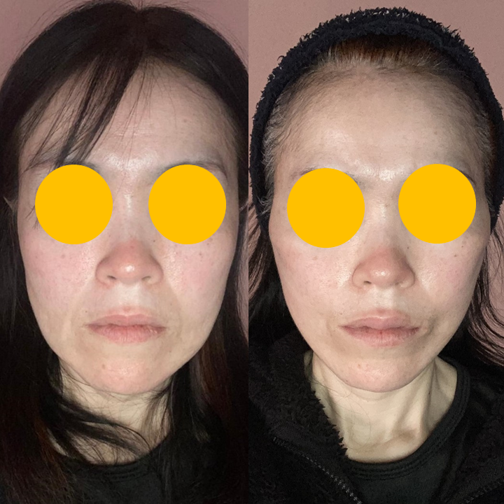 미니거상에서 딥플레인 테크닉의 적용 관련 이미지 7