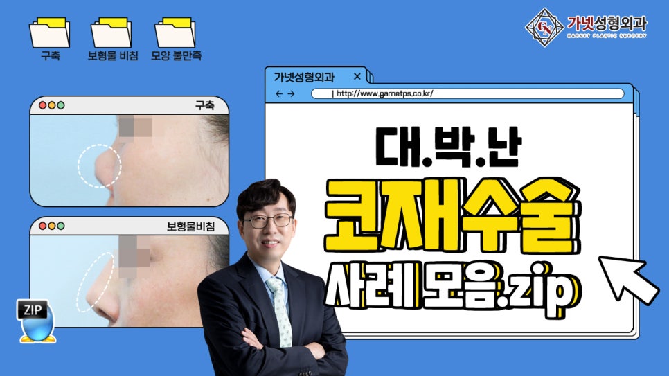 Why You Should Have Revision Rhinoplasty at a Place That Specializes in Apgujeong Nose Revision Surgery (ft. Dr. Baek In-soo) image 1