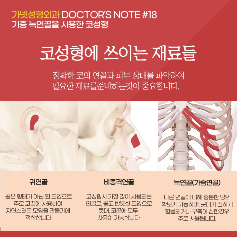 [Garnet Plastic Surgery Director Baek In-soo's Plastic Surgery Column] Rhinoplasty Using Donated Rib Cartilage image 2