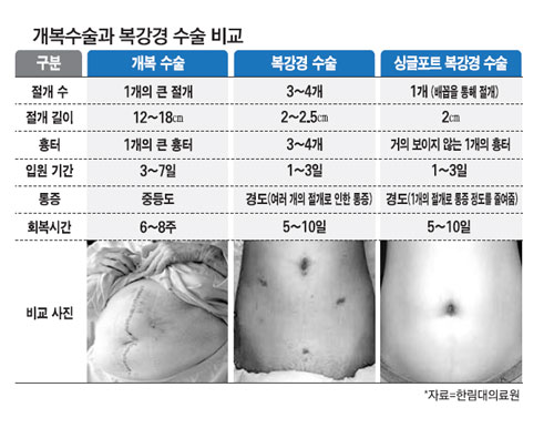 70대도 편하게 받는 내시경 이마거상 관련 이미지 1