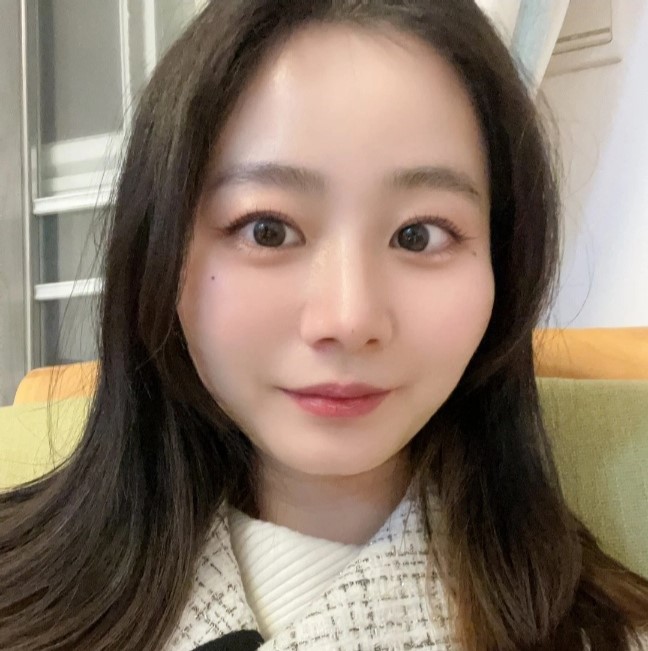 눈밑지방재배치와 애교살지방이식의 유지기간 관련 이미지 7