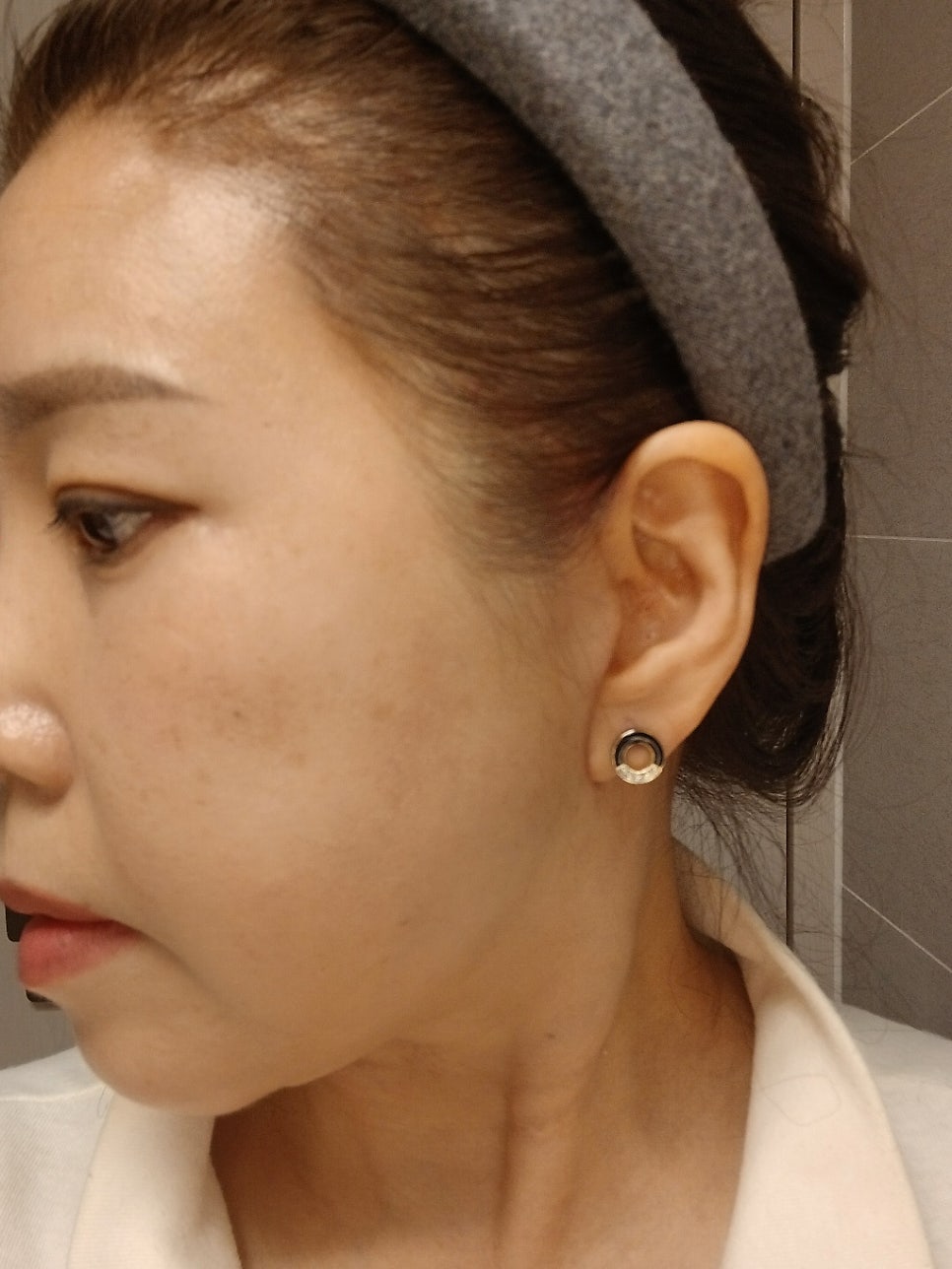 중년종합성형 상담과 수술의 범위 관련 이미지 7