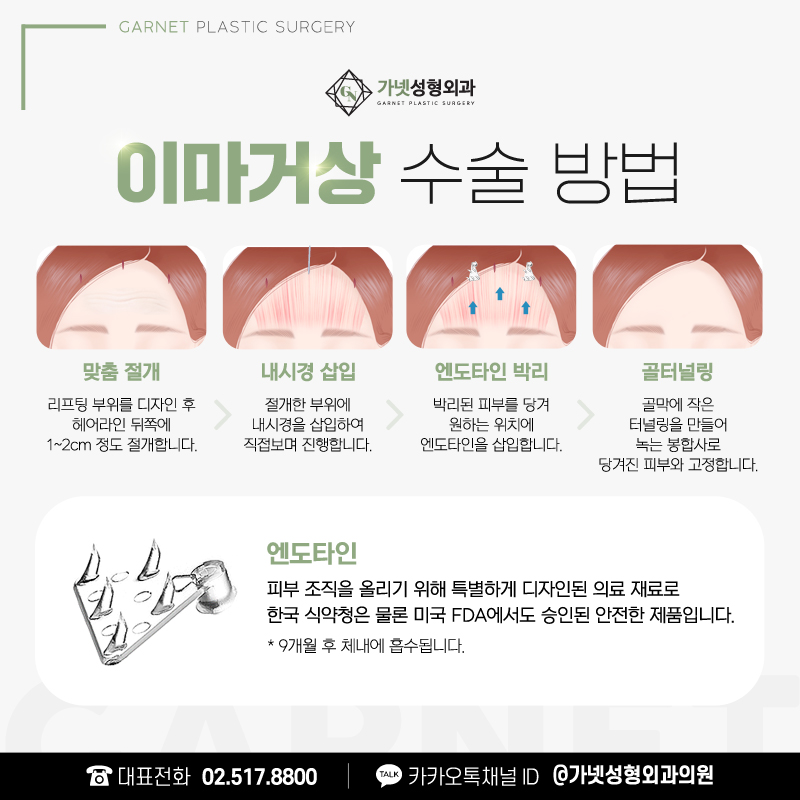 가넷성형외과에서 알아보는 동안성형의 종류와 효과 관련 이미지 14