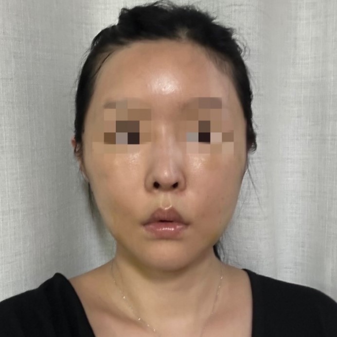 Natural Thread Lifting Using the Face’s Glide Planes image 6
