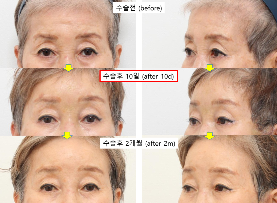 70대도 편하게 받는 내시경 이마거상 관련 이미지 6
