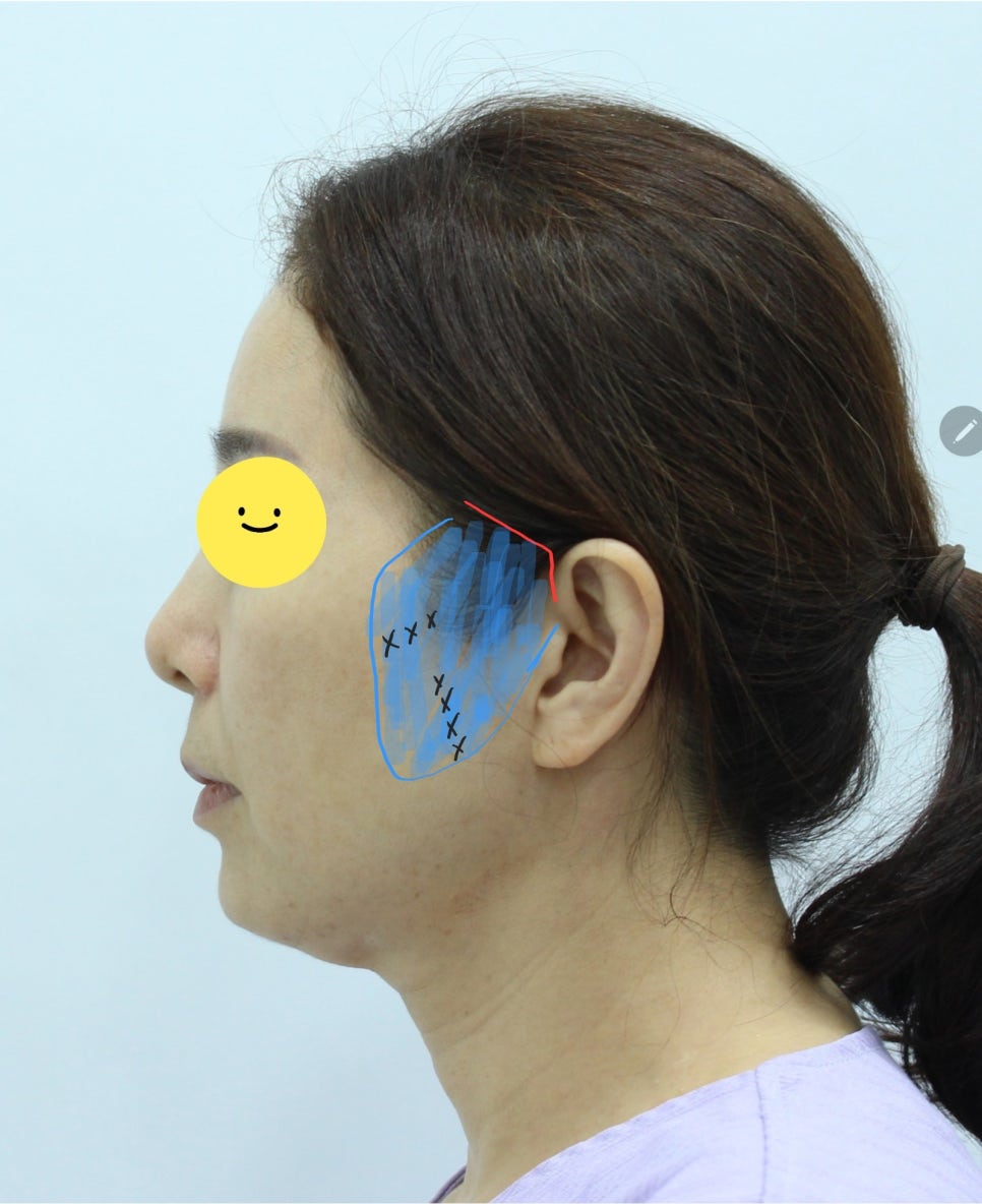 미니거상의 종류 관련 이미지 5
