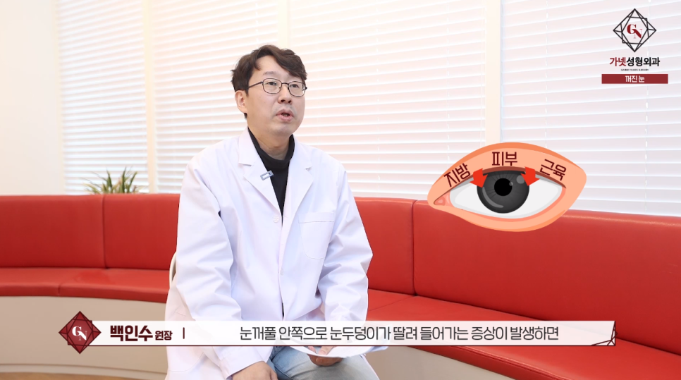 꺼진눈 수술, 지방이식? 눈위지방재배치? 안검하수 여부 체크해 보세요! 관련 이미지 2