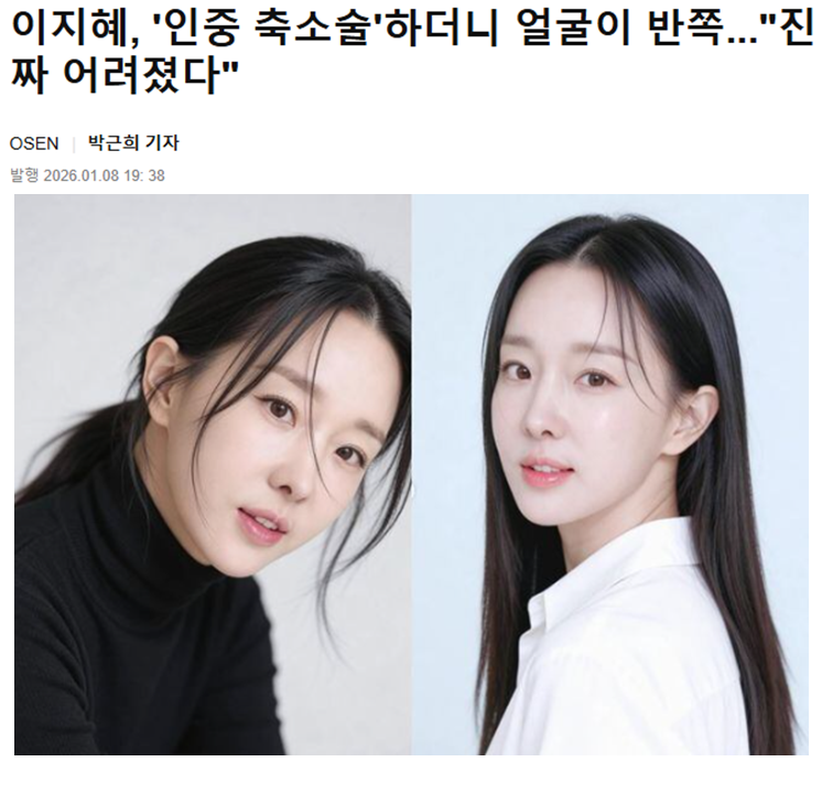 인중축소술로 완성하는 동안 얼굴, 10년 어려 보이는 비결 관련 이미지 1
