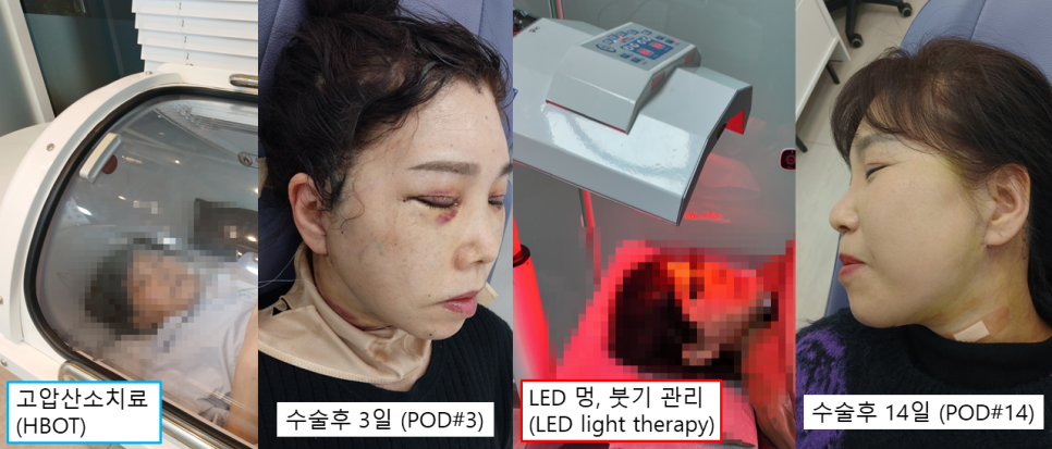 수술만큼 중요한 회복, 결과를 바꾸는 관리의 차이 관련 이미지 3