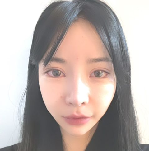 Sagging Skin After Facial Contouring Surgery (Cheek Sagging) image 11
