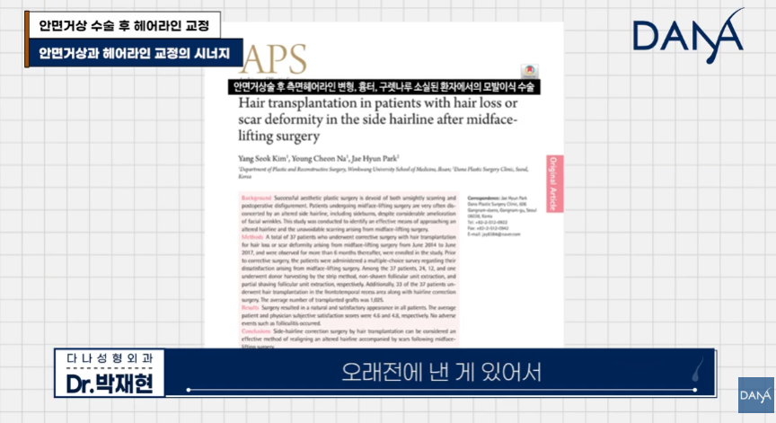 안면거상술 후 흉터와 헤어라인 변형, 자연스럽게 해결하는 방법 관련 이미지 6