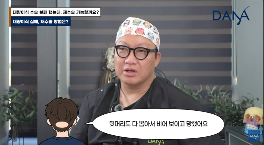 해외 원정 모발이식! 조심스럽게 만류하는 이유 관련 이미지 3
