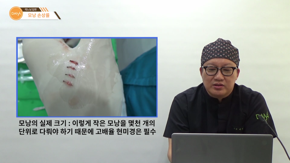 Factors That Affect Follicle Damage Rates During Hair Transplant Surgery image 1