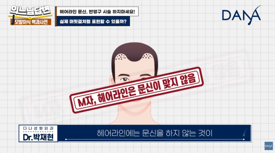 Why You Should Never Get a Hairline Scalp Tattoo image 8