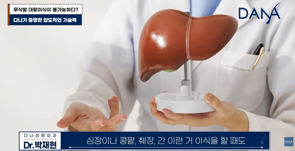 무삭발 모발이식이르 3000모 대량이식 가능할까? 생착률 높이는 진짜비밀 관련 이미지 19
