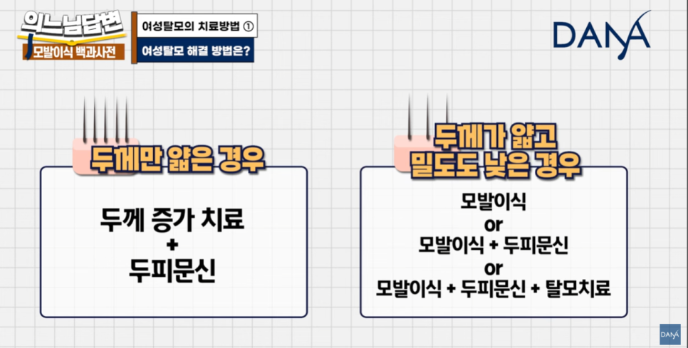 여성형 탈모, 두피문신vs모발이식? 관련 이미지 13