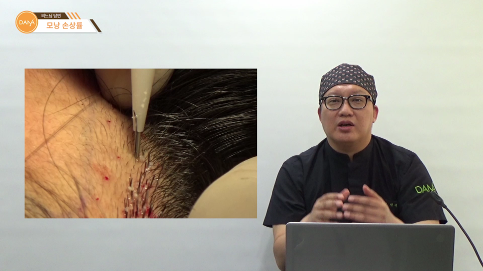 Factors That Affect Follicle Damage Rates During Hair Transplant Surgery image 3