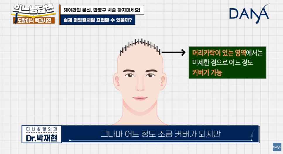 Why You Should Never Get a Hairline Scalp Tattoo image 7