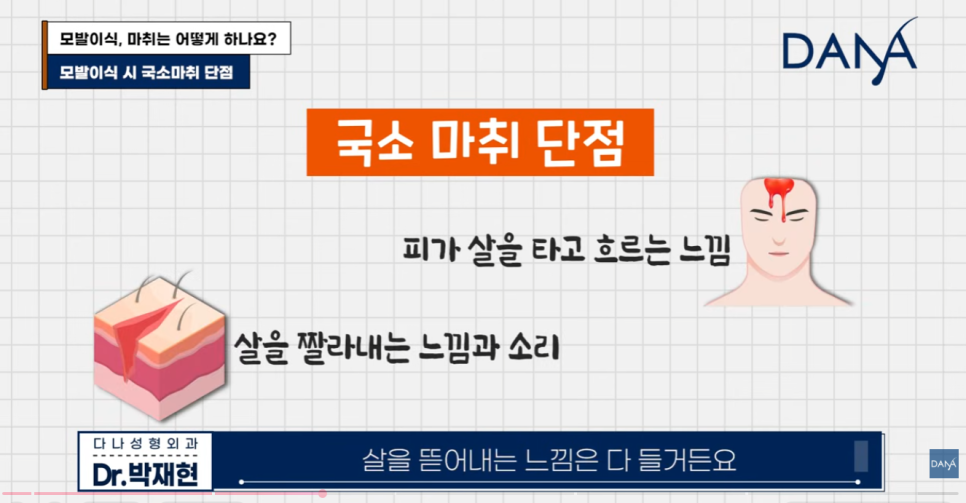 모발이식 마취 통증 걱정된다면? 국소마취 vs 수면마취 장단점 비교 선택 기준 관련 이미지 6