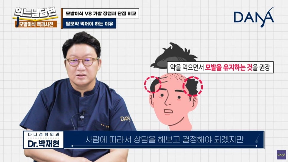 모발이식 VS 가발, 가발의 장점과 단점은? 관련 이미지 8