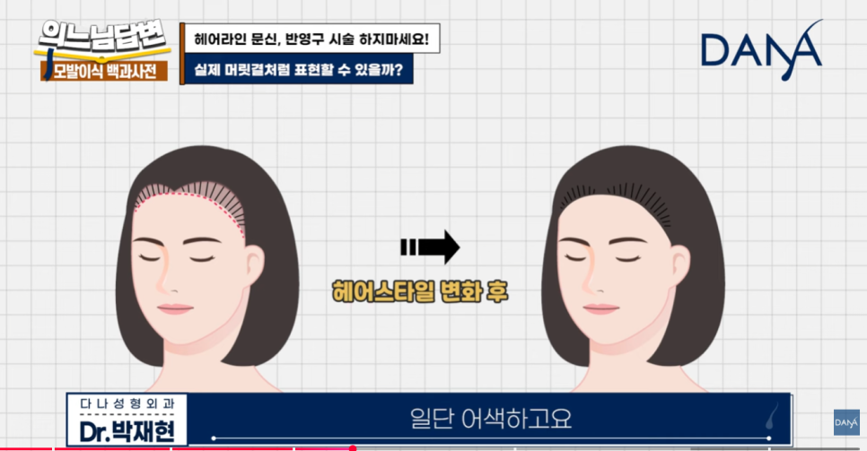 Why You Should Never Get a Hairline Scalp Tattoo image 4