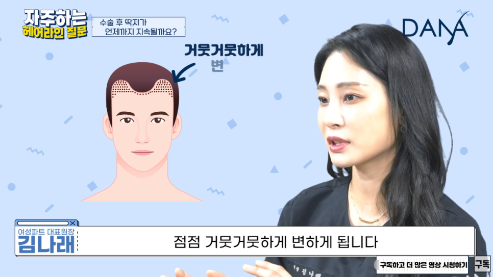 Scabs After Hair Transplant Surgery: How Long Do They Last and How Can They Be Removed? image 3