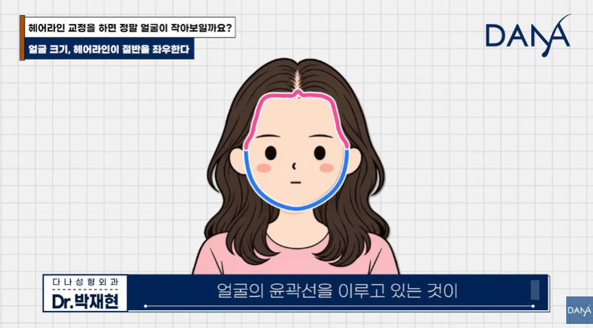 넙데데한 얼굴이 고민이라면? 상위 1% 원장님이 말하는 진짜 안면 축소술 관련 이미지 16