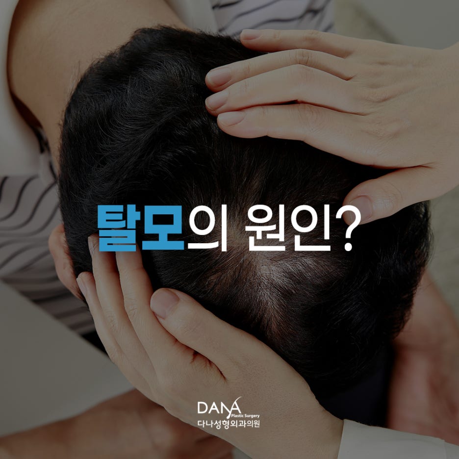 탈모의 원인과 적절한 치료 방법 관련 이미지 4