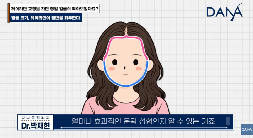 넙데데한 얼굴이 고민이라면? 상위 1% 원장님이 말하는 진짜 안면 축소술 관련 이미지 18