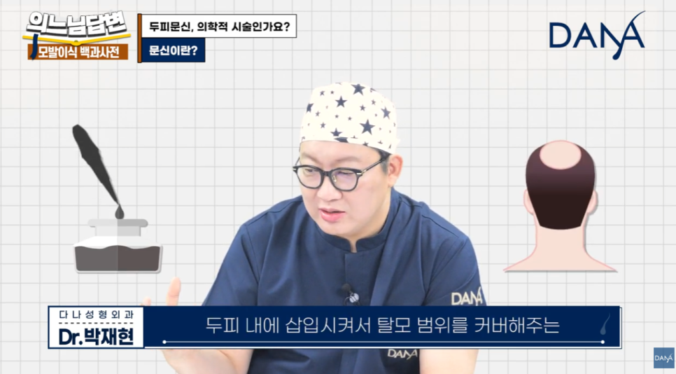 두피문신, 단순 타투일까 의학적 시술일까? 관련 이미지 13