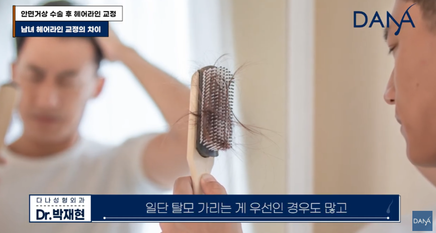 안면거상술 후 흉터와 헤어라인 변형, 자연스럽게 해결하는 방법 관련 이미지 28