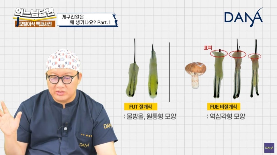 Why Frog-Egg-Like Bumps Appear After Hair Transplant_Series 1 image 7