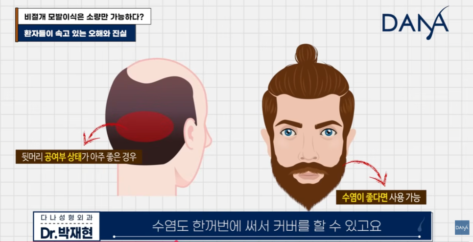 비절개 모발이식 왜 소량만 가능하다고 알려졌을까? 관련 이미지 5