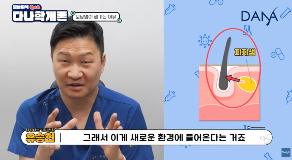 모발이식 후 모낭염, 수술 실패일까? 원인과 대처 꿀팁! 관련 이미지 5