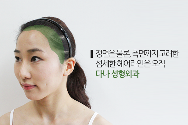 Were They Born with Celebrity Hairline Correction? image 3