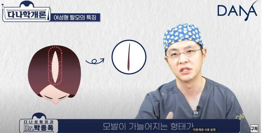 여성탈모,남성탈모와 차이점은 관련 이미지 5