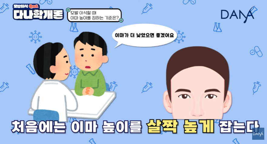 모발이식 이마 높이 정하는 기준! 무작정 낮추면 안되는 이유 관련 이미지 6