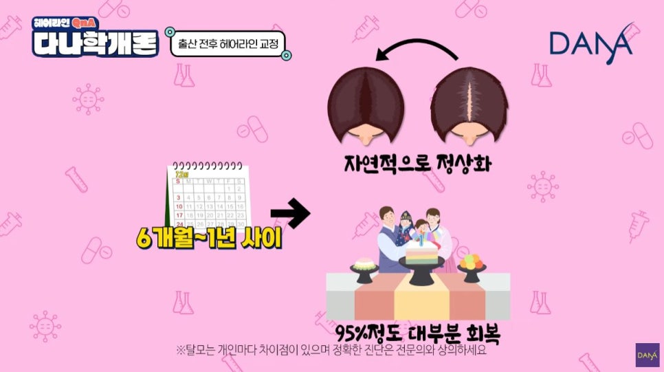 산후탈모 출산 후 생기는 이유와 헤어라인교정 시기는? 관련 이미지 6
