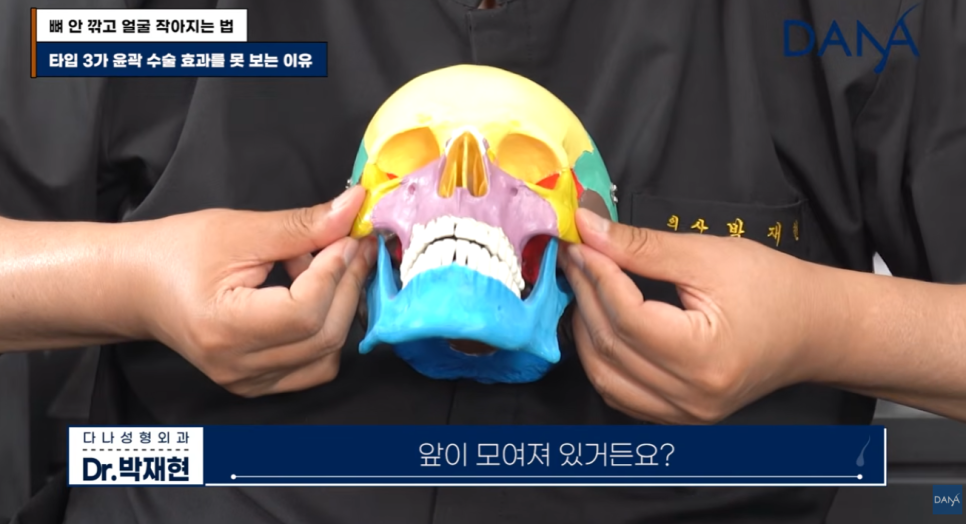 뼈 안 깎고 얼굴 작아지는 법? 광대 수술 효과 없는 관련 이미지 11