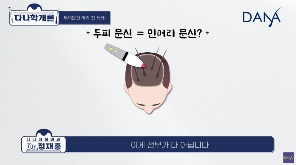 두피문신 전, 꼭 알아봐야 할 사항들 관련 이미지 3