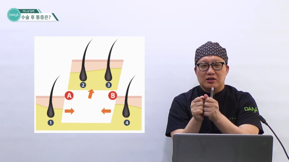 How to Reduce Pain After Hair Transplant Surgery image 6