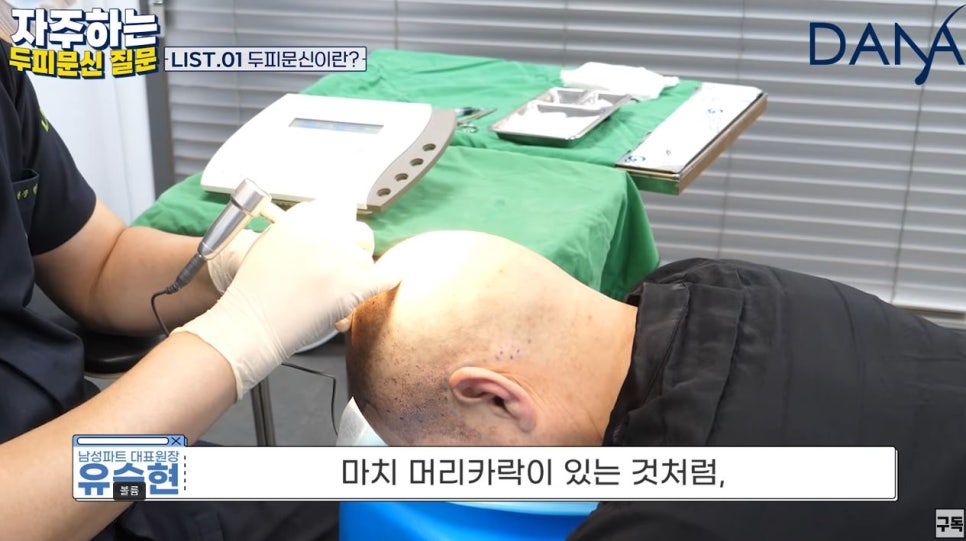 What Are the Effects of Tattooing for Hair Loss? (feat. What Is Scalp Micropigmentation?) image 2