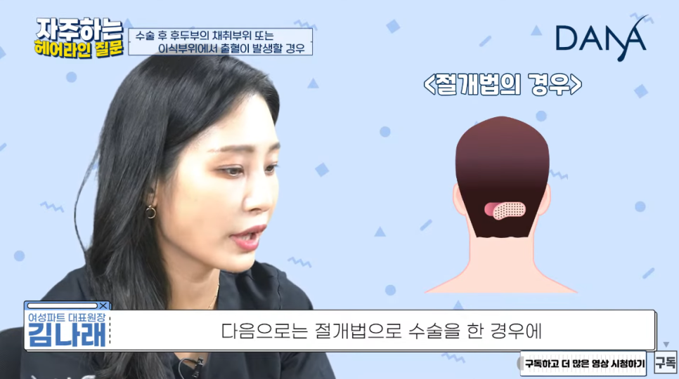 모발이식 수술 후 이식부위에 피가 난다면? 관련 이미지 4