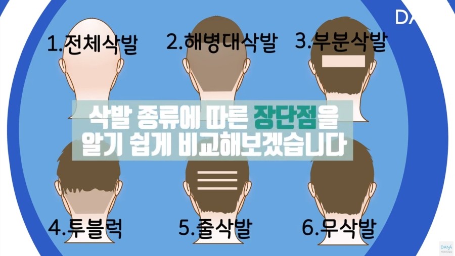 비절개 모발이식 시 삭발방법 종류 관련 이미지 3