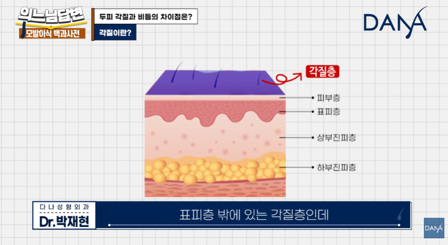 머리 잘 감아도 비듬 생기는 뜻밖의 원인! 두피 각질 차이 및 해결법 관련 이미지 4